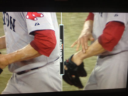 buchholz arm